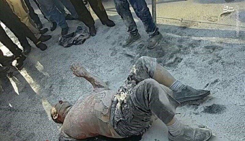 وضعیت مصدوم حادثه خودسوزی مقابل شهرداری وخیم است وضعیت مصدوم حادثه خودسوزی مقابل شهرداری وخیم است