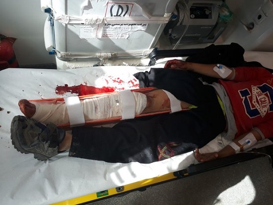 حمله خرس به یک کودک در چهارمحال و بختیاری حمله خرس به یک کودک در چهارمحال و بختیاری