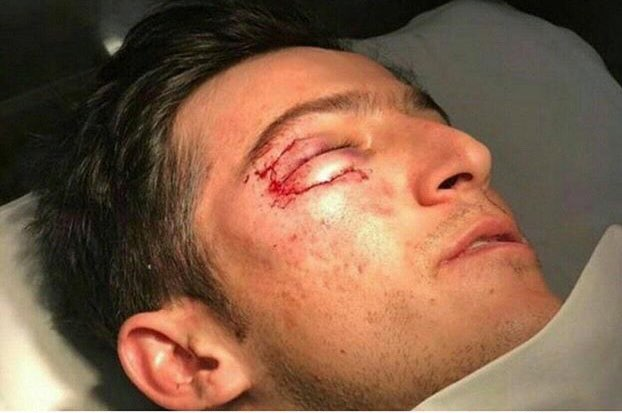 مصدومیت شدید سردار در تمرین امروز روبین کازان+عکس مصدومیت شدید سردار در تمرین امروز روبین کازان+عکس