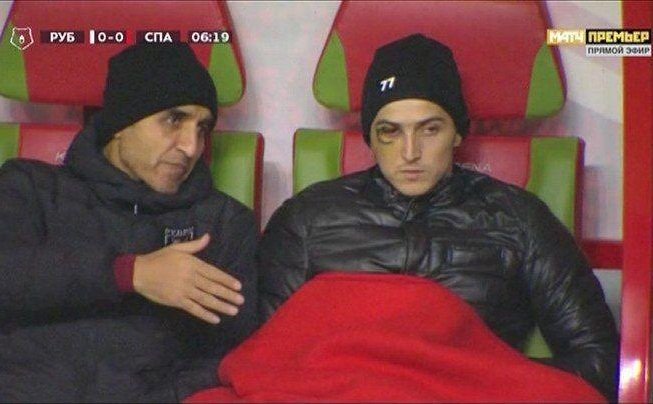 مصدومیت شدید سردار در تمرین امروز روبین کازان+عکس مصدومیت شدید سردار در تمرین امروز روبین کازان+عکس